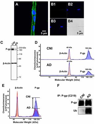 Preventing P-gp Ubiquitination Lowers Aβ Brain Levels in an Alzheimer’s Disease Mouse Model